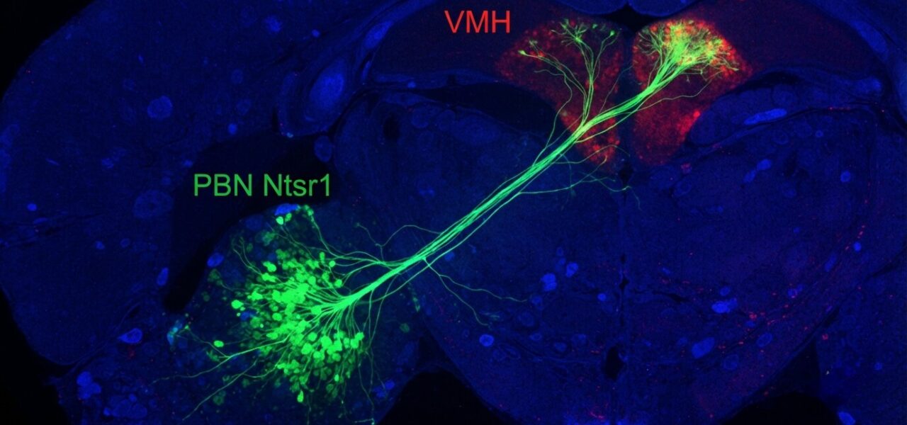A new study found the brain circuit that explains why you lose your appetite when you are anxious, and discovered it works like a single switch controlling both at once