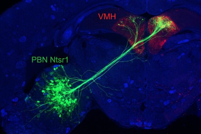 A new study found the brain circuit that explains why you lose your appetite when you are anxious, and discovered it works like a single switch controlling both at once
